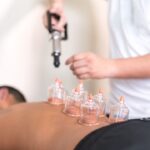 Cupping Therapy