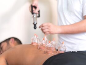 Cupping Therapy