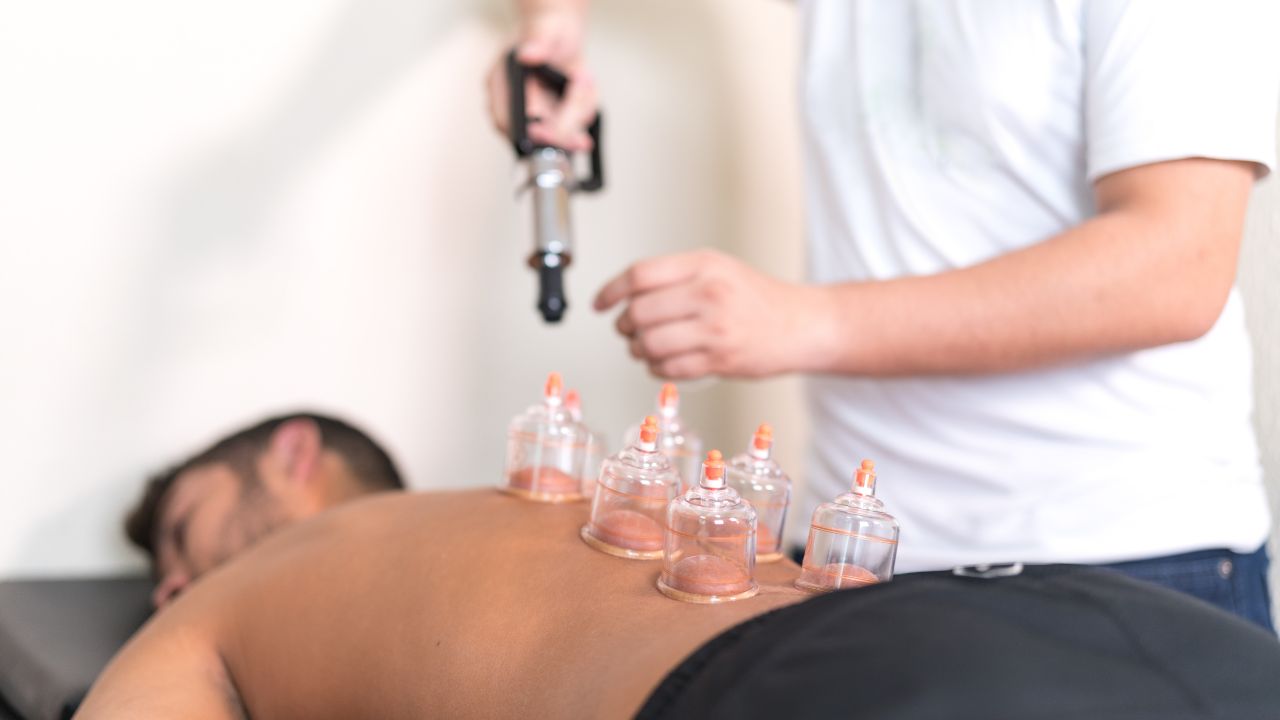 Cupping Therapy